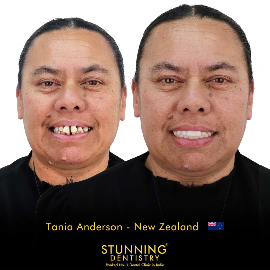 Before and after case 7